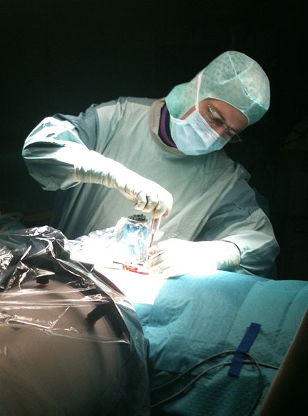 professional neurosurgeon : Robotic Spinal Surgery